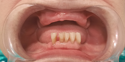 06dientes-en-un-dia-trabajos